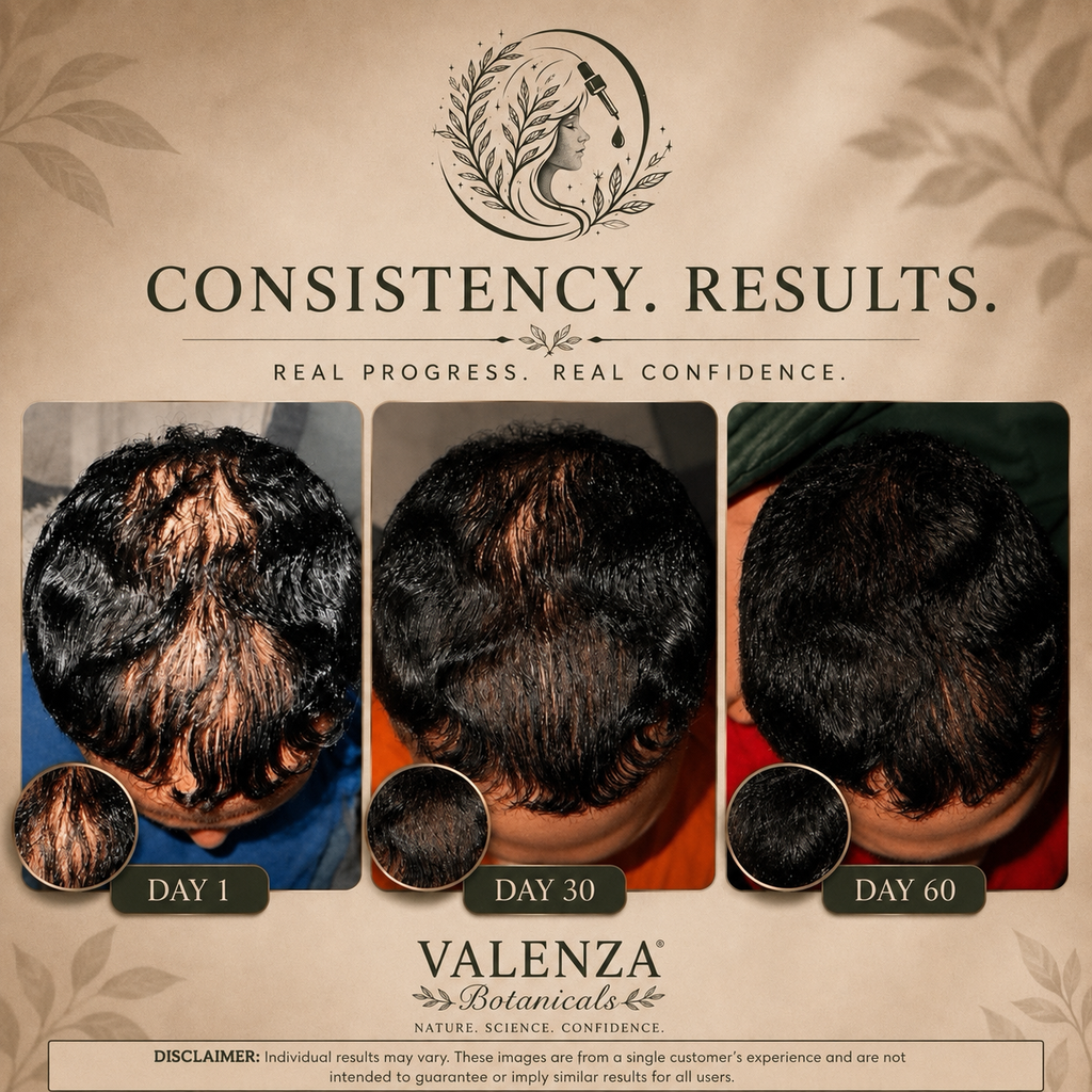 Valenza Botanicals Hair Growth Elixir