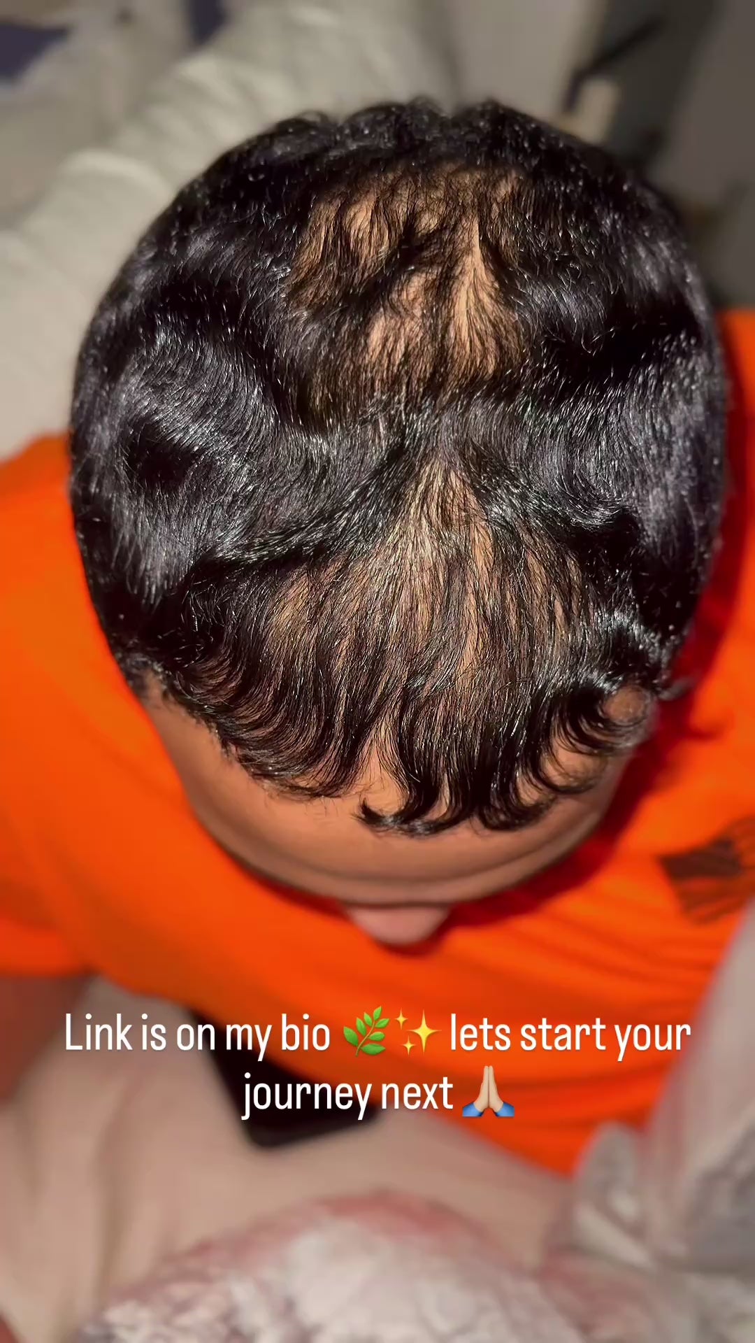 Valenza Botanicals Hair Growth Elixir